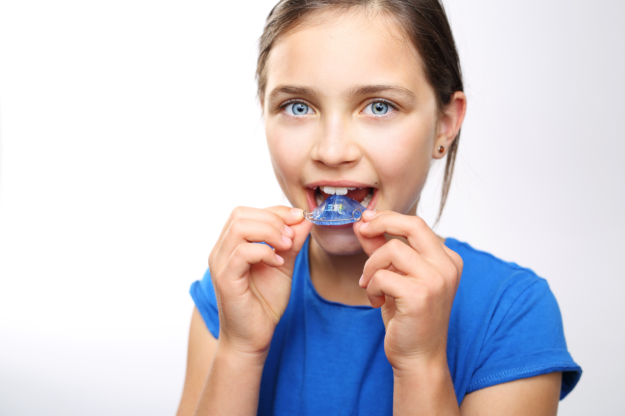 Children's orthodontic appliances are generally well tolerated.
