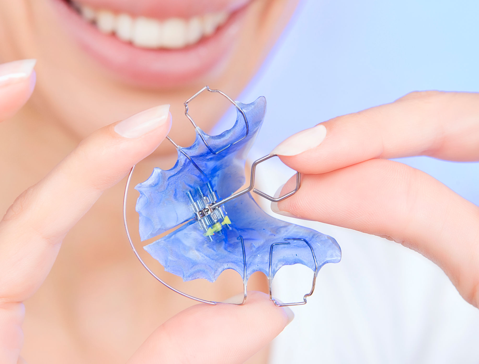 Everything About Night Braces