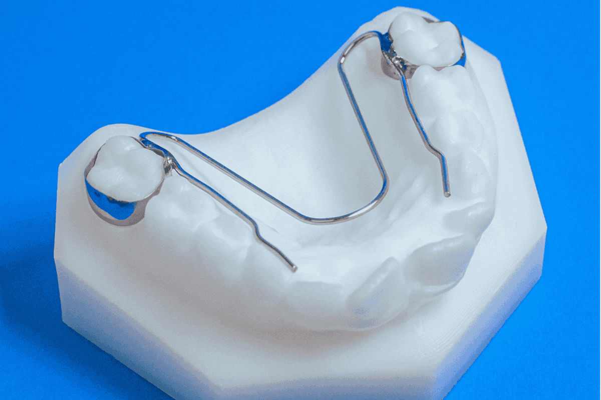 Nance orthodontic appliance