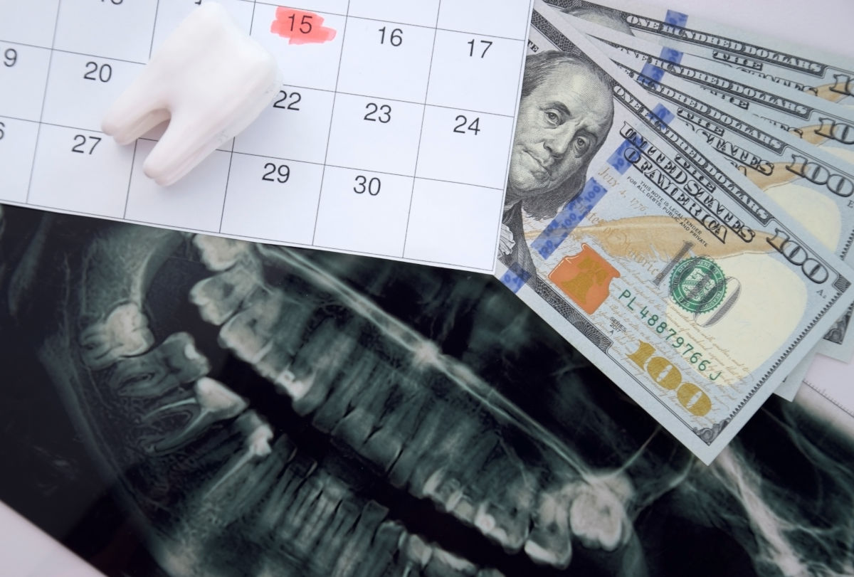 Dental Financing in 2026: How to Pay for Implants, Crowns, and Major Dental Work