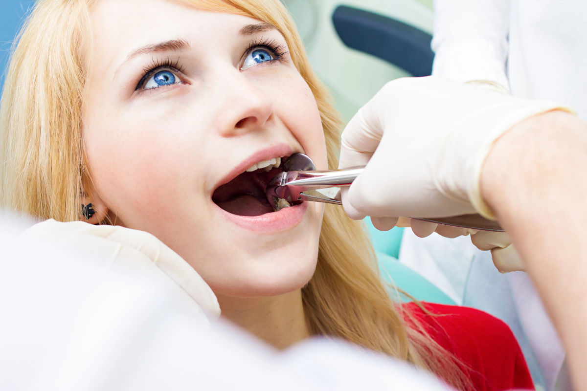 Tooth Extraction in 2026: Procedures, Costs, Recovery, and What to Expect