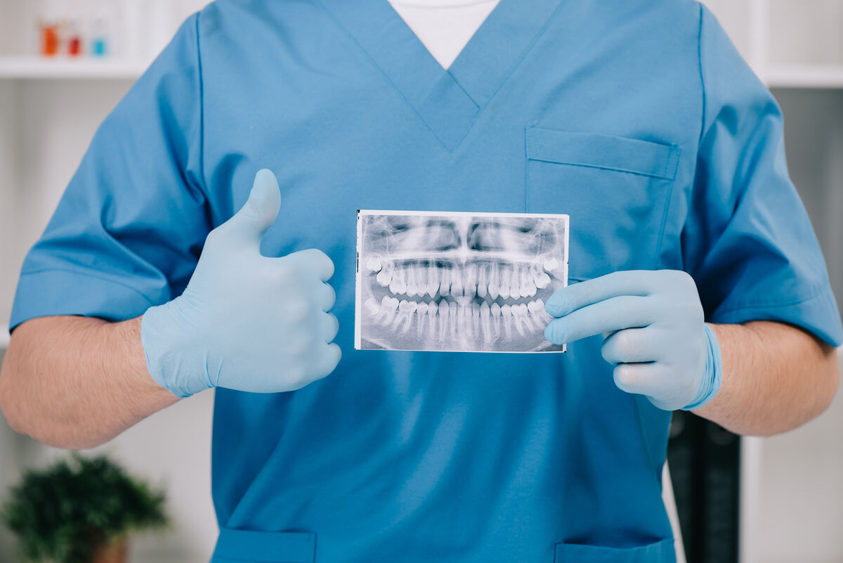 Panoramic dental X-ray showing the position of wisdom teeth