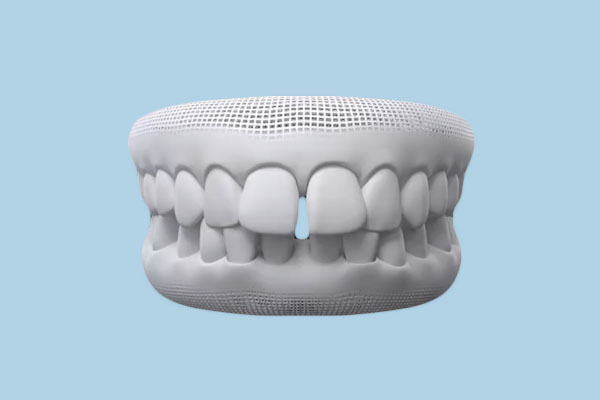 Charming smile with a prominent gap between the front teeth