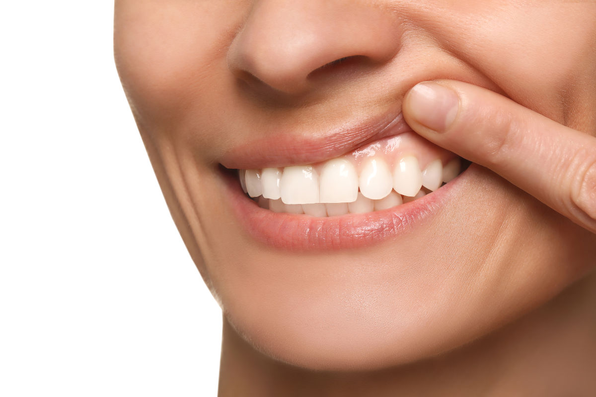 Gingivectomy: Everything to Know About Surgical Gum Removal