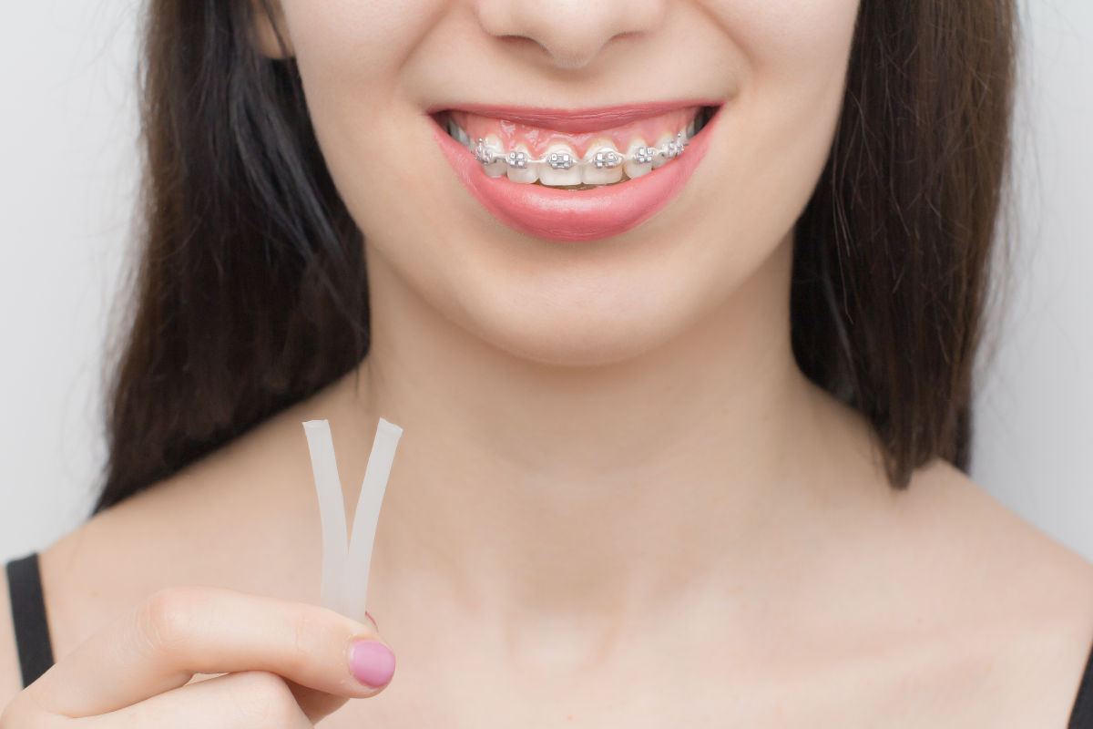 Orthodontic Wax: How to Use It Correctly to Relieve Pain