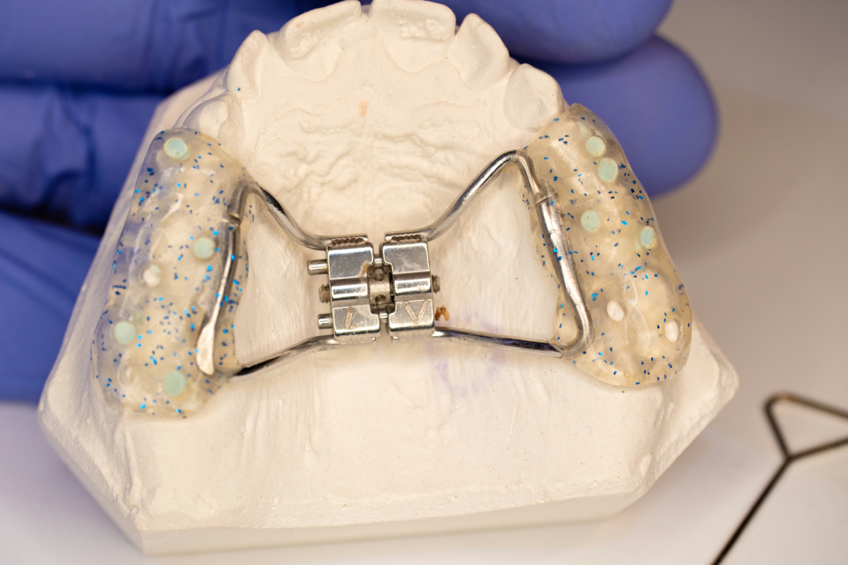 Palatal expander for a child