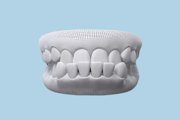 Prognathism: Causes, Consequences, and Solutions