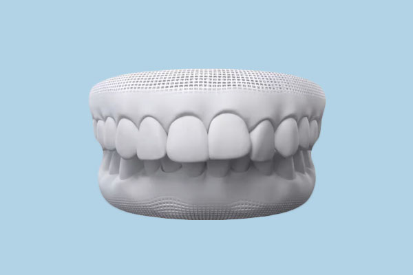 Retrognathia: Causes, Consequences, and Solutions for Protruding Teeth