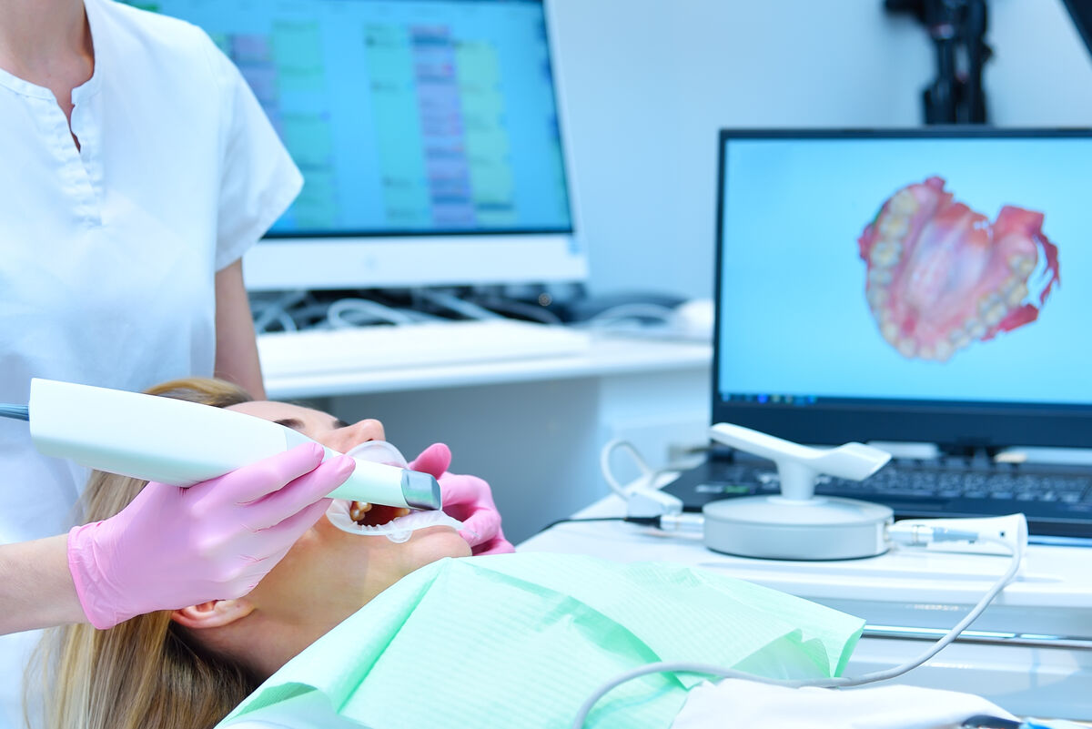 3D dental scanner used for aligner design