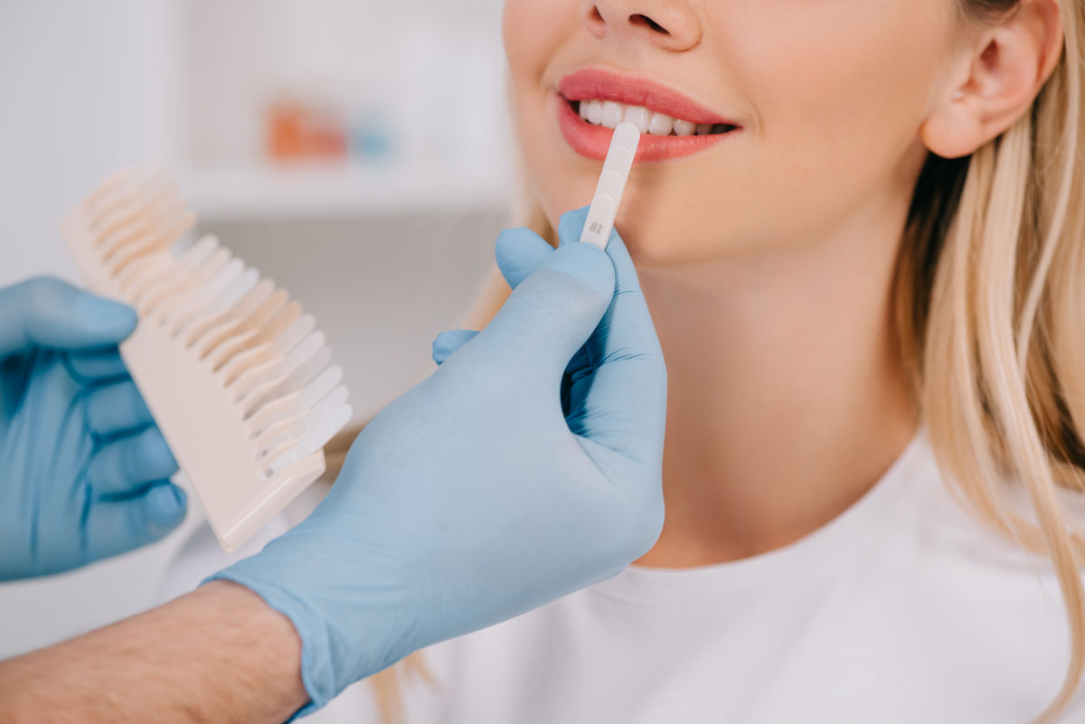 Teeth Whitening Kiosks and Smile Bars: Risks, Costs, and Safer Alternatives