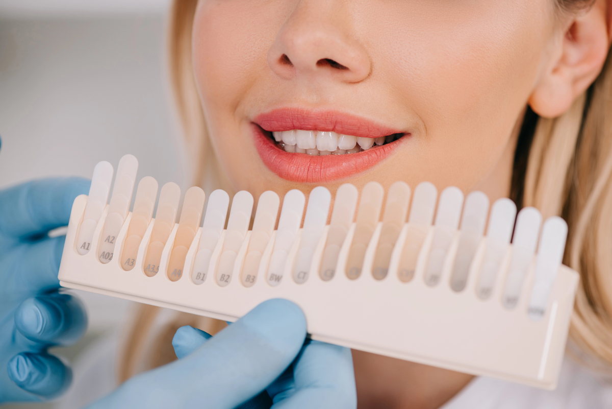 Teeth Whitening: Cost, Insurance Coverage, and Risks