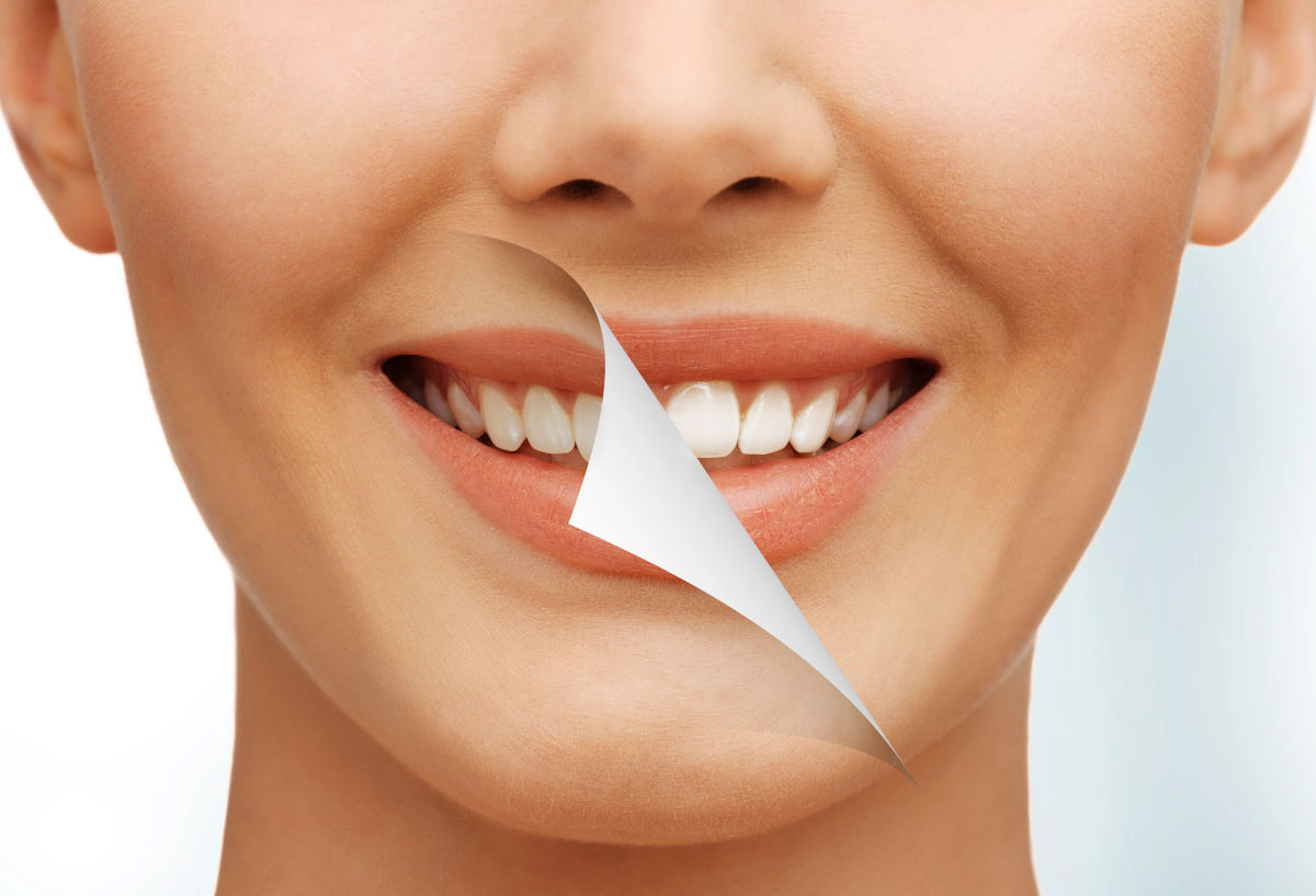 How to Get White Teeth: The Different Methods of Teeth Whitening